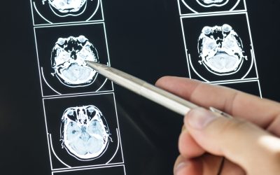Finding the Best Brain and Spine Injury Lawyer