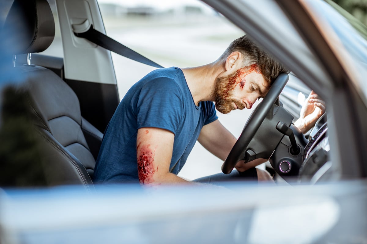 A man with blood on his face sits in a car's driver's seat, indicating a serious road accident