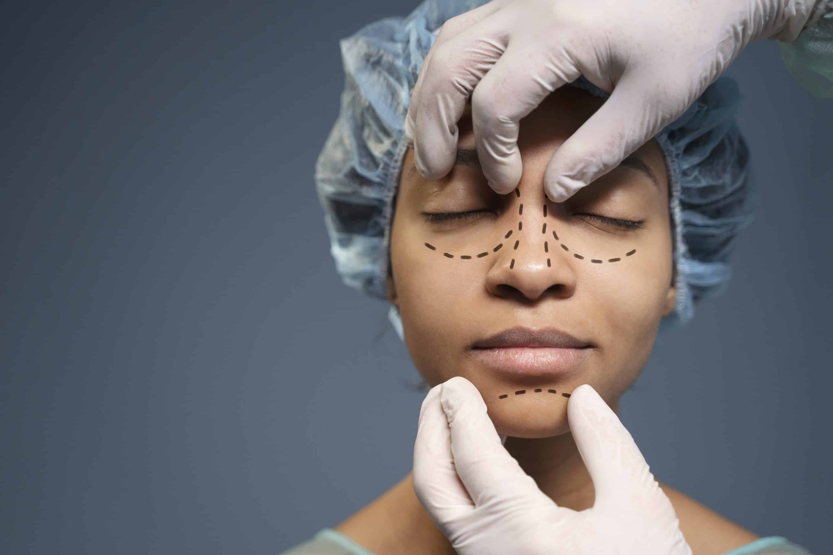 Rhinoplasty or cosmetic facial procedure consultation with surgeon's hands and pre-op marking lines